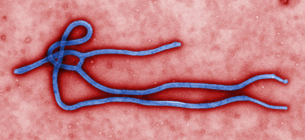 Transmission electron photograph of Ebola filovirus. Viruses such as this can spread naturally or be weaponized, both resulting in local and global devastation. 2008. (Global Panorama, Flickr Creative Commons)